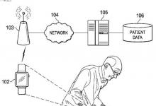 未来的Apple Watch可以帮助诊断治疗帕金森氏病